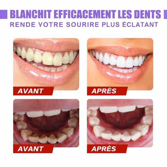 Kit Sourire Éclatant - Bandes de Blanchiment